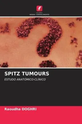 Produktbild von Spitz Tumours