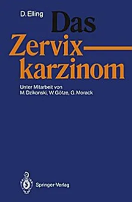 Obrázek produktu pro Das Zervixkarzinom