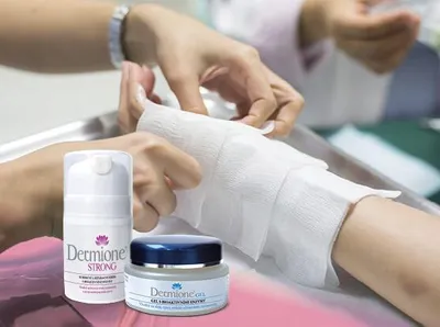 Immagine prodotto di Dermione® - Prodotti per la cura e la riparazione della pelle localmente bruciata