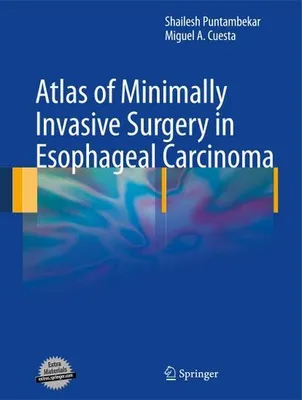 Obrázok produktu pre Atlas of Minimally Invasive Surgery in Esophageal Carcinoma