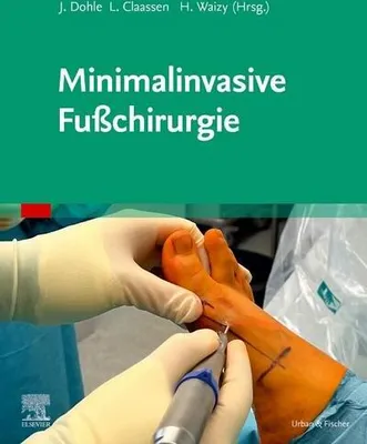 Obrázek produktu pro Minimalinvasive Fußchirurgie