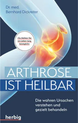 Immagine prodotto di Arthrose ist heilbar