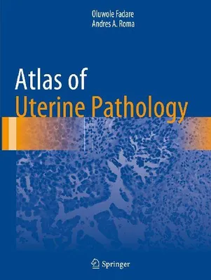 Produktbild von Atlas of Uterine Pathology
