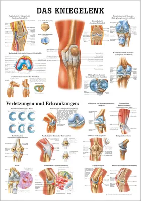 Produktbild von Das Kniegelenk Lehrtafel Anatomie 100x70 cm medizinische Lehrmittel