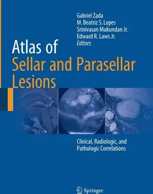 Obrázok produktu pre Atlas of Sellar and Parasellar Lesions
