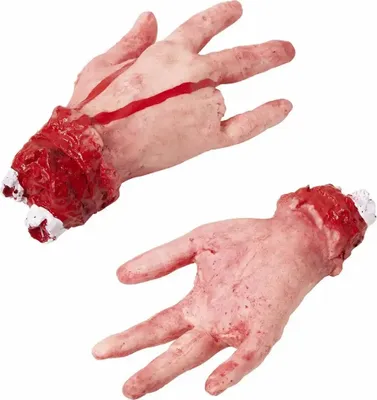 Immagine prodotto di Mano mozzata con dito mancante