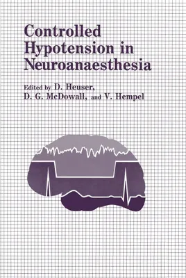 Produktbild von Controlled Hypotension in Neuroanaesthesia