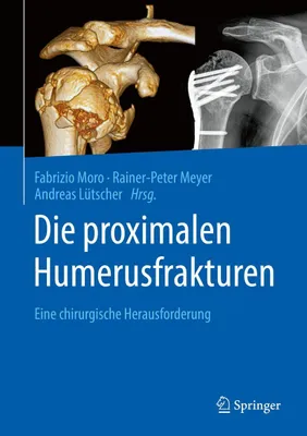Produktbild von Die proximalen Humerusfrakturen