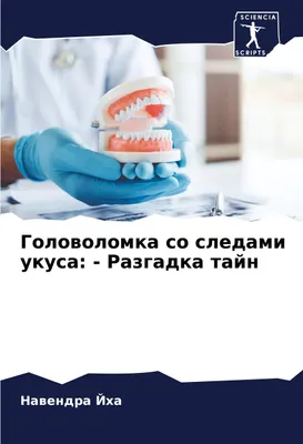 Produktbild von Golowolomka so sledami ukusa: - Razgadka tajn