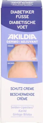 Produktbild von AKILDIA Fuß Schutzcreme für Diabetiker, 75 ml Creme
