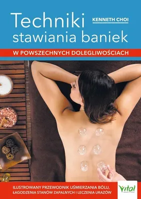 Zdjęcie produktu dla Techniki stawiania baniek
