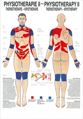 Produktbild von Thermotherapie Poster Anatomie 70x50 cm medizinische Lehrmittel