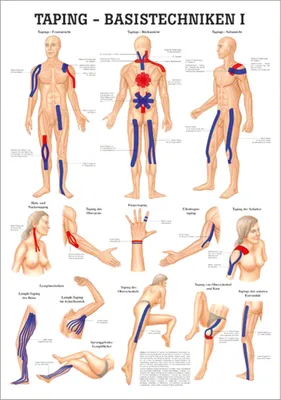 Produktbild von Taping Basistechniken I Lehrtafel Anatomie 100x70 cm medizinische Lehrmittel