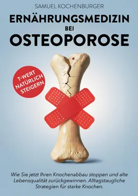 Produktbild von Ernährungsmedizin bei Osteoporose