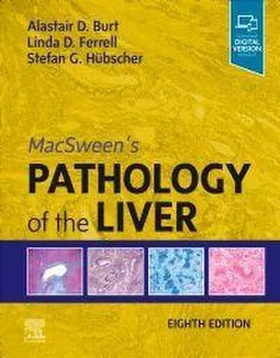 Image de MacSween's Pathology of the Liver