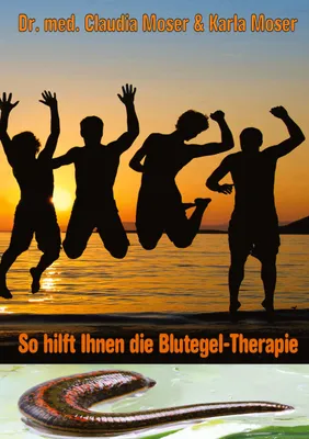Produktbild von So hilft ihnen die Blutegeltherapie