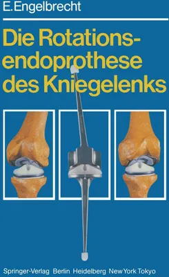 Produktbild von Die Rotationsendoprothese des Kniegelenks