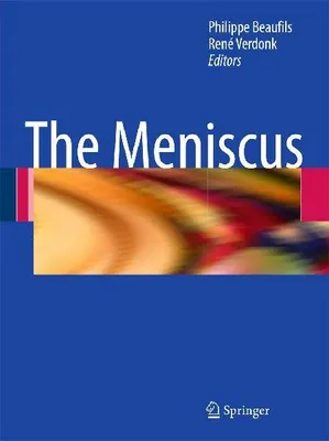 Produktbild von The Meniscus