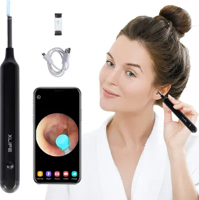 Obrázek produktu pro Otoskop pro odstraňování ušního mazu, čistič uší, s LED světlem a 3,5 mm čočkou, vodotěsný mini otoskop