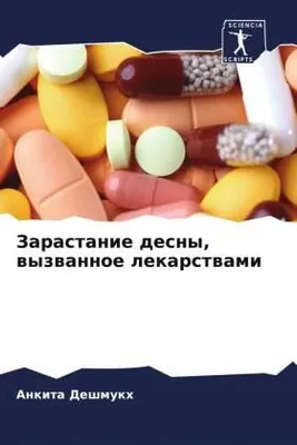 Produktbild von Zarastanie desny, wyzwannoe lekarstwami