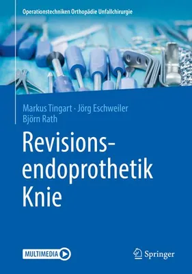 Immagine prodotto di Revisionsendoprothetik Knie