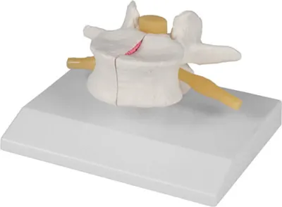 Immagine prodotto di Modello di vertebra di Erler per osteoporosi, ingrandito 2 volte