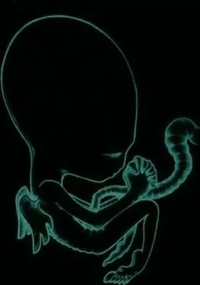 Image de Début d'Agaetis