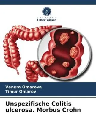 Produktbild von Unspezifische Colitis ulcerosa. Morbus Crohn