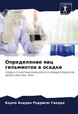 Produktbild von Opredelenie qic gel'mintow w osadke