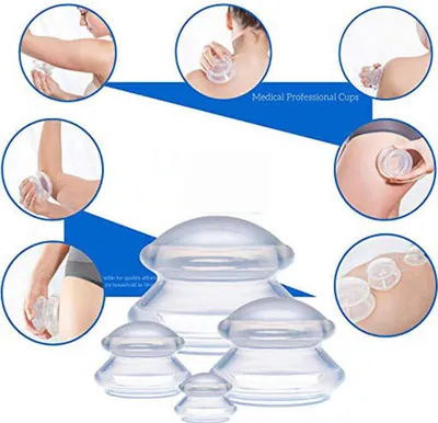Produktbild von INF Schröpfköpfe für Ganzkörpermassage 4er Pack (L-XS) Weiß