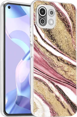Immagine prodotto di Custodia per Xiaomi Mi 11 Lite 4G/5G Cover protettiva Marmo Motif Custodia per telefoni cellulari Silicone Slim Cover