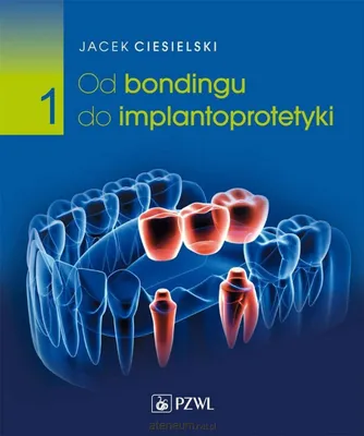 Produktbild von Vom Kleben zur Implantatprothetik Teil I