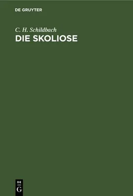 Produktbild von Die Skoliose
