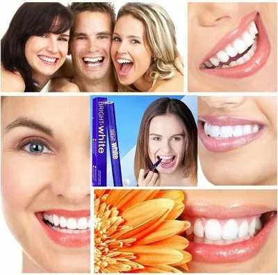 Produktbild von 4 Stück Teeth Whitening Pen Gel Zahnbleichstift Dental Zahnaufheller