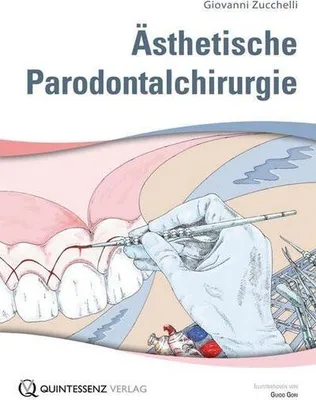 Produktbild von Ästhetische Parodontalchirurgie