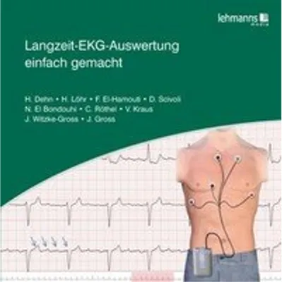 Image de Langzeit-EKG-Auswertung einfach gemacht