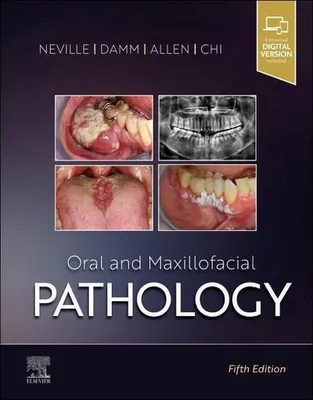 Zdjęcie produktu dla Oral & Maxillofacial Pathology