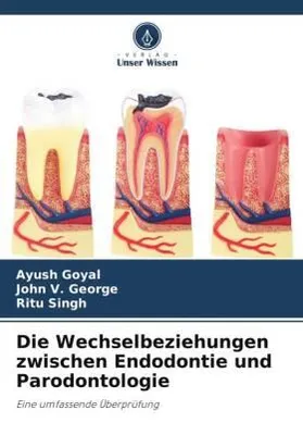 Produktbild von Die Wechselbeziehungen zwischen Endodontie und Parodontologie