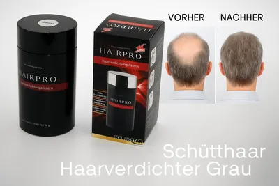 Image de LALabs épaississant pour cheveux Hairpro-brun moyen