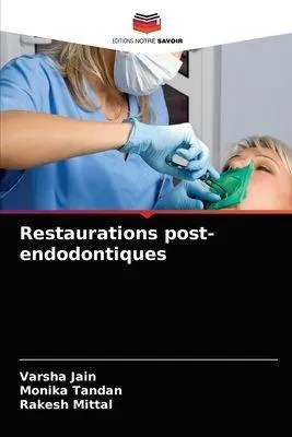 Produktbild von Restaurations post-endodontiques