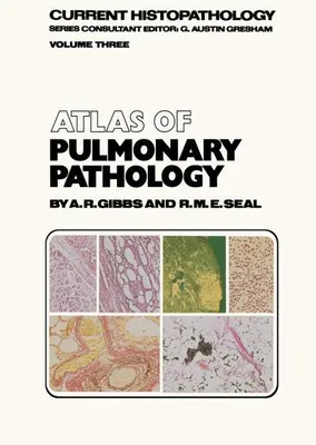 Obrázok produktu pre Atlas of Pulmonary Pathology