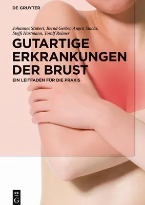Immagine prodotto di Gutartige Erkrankungen der Brust
