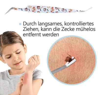 Obrázek produktu pro Profesionální kleště na klíšťata Perfect 2 v 1 – pro psy a kočky – světle modré