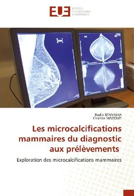 Produktbild von Les microcalcifications mammaires du diagnostic aux prélèvements