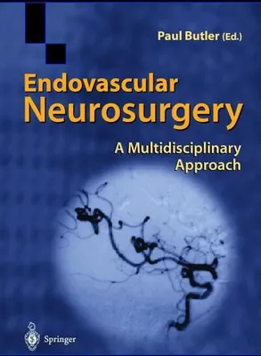 Produktbild von Endovascular Neurosurgery