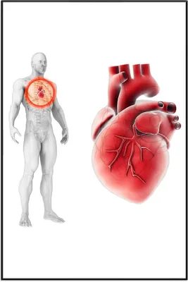 Produktbild von Wallario Wandbild Anatomie des Menschen  Herz in Nahansicht, Größe: 61 x 91,50 cm, Poster mit schwarzem Aluminiumrahmen