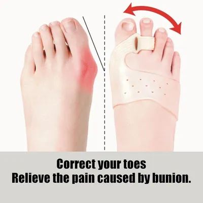 Produktbild von Hallux Valgus Korrektor 2er Set, Zehenorthese mit Magnetunterstützung, Schmerzlinderung, komfortabel - ToeCorrect