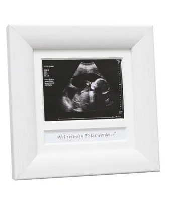 Produktbild von Deknudt Echographie Rahmen weiß 10x10 cm Englisch
