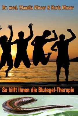 Produktbild von So hilft ihnen die Blutegeltherapie