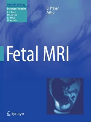 Immagine prodotto di Fetal MRI